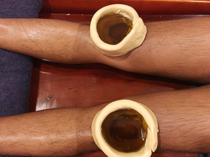 Ayurvedic Treatment for Knee Joint Pain